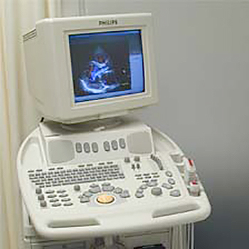 超音波検査（心臓・血管）